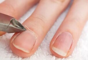 Adeus ao alicate: por que dermatologistas recomendam parar de remover as cutículas