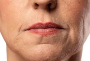 Três cosméticos coreanos que ajudam a atenuar o bigode chinês e firmar a pele do rosto
