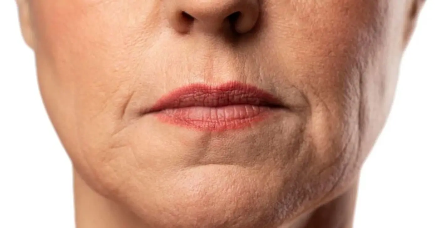 Três cosméticos coreanos que ajudam a atenuar o bigode chinês e firmar a pele do rosto